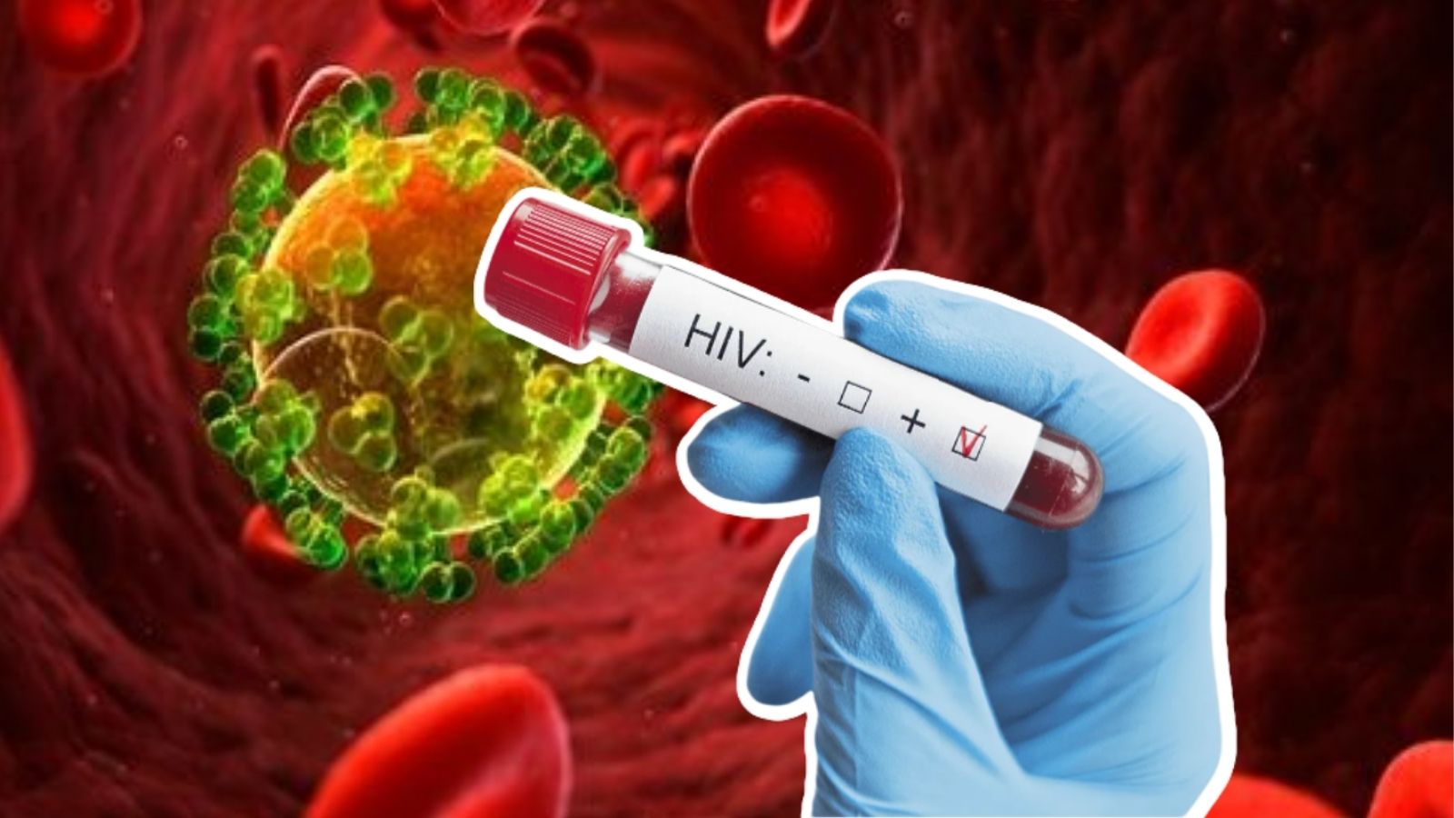 Paciente se cura de VIH con células madre