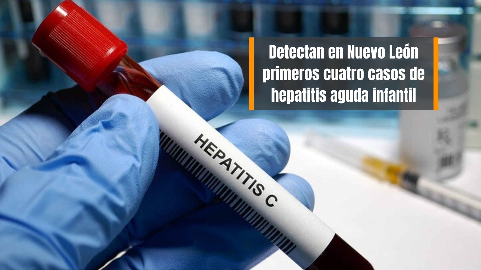 Reportan cuatro casos de hepatitis aguda infantil en Nuevo León