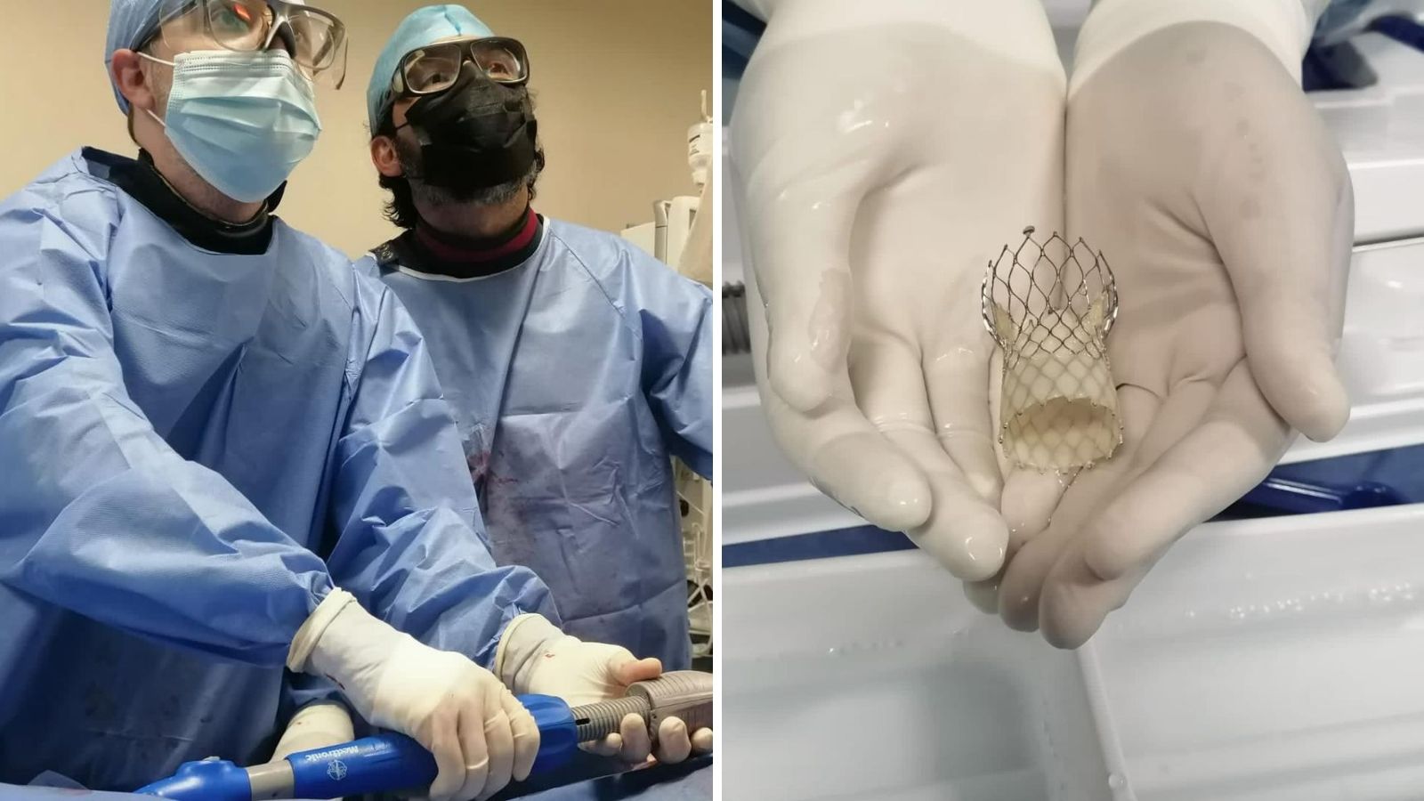 Colocan con éxito primer implante valvular aórtico en Hospital Regional del ISSSTE en Mérida