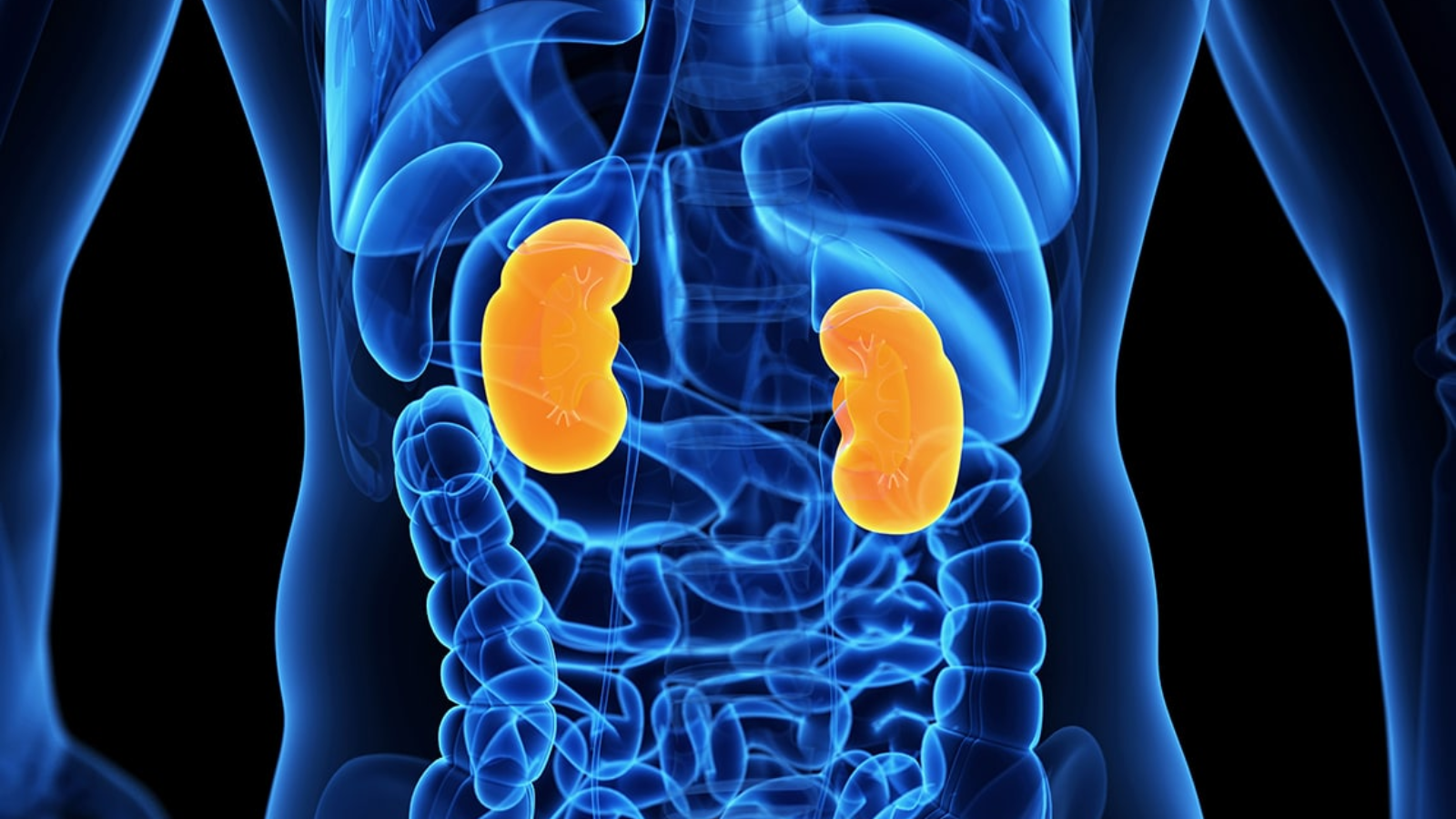cáncer renal