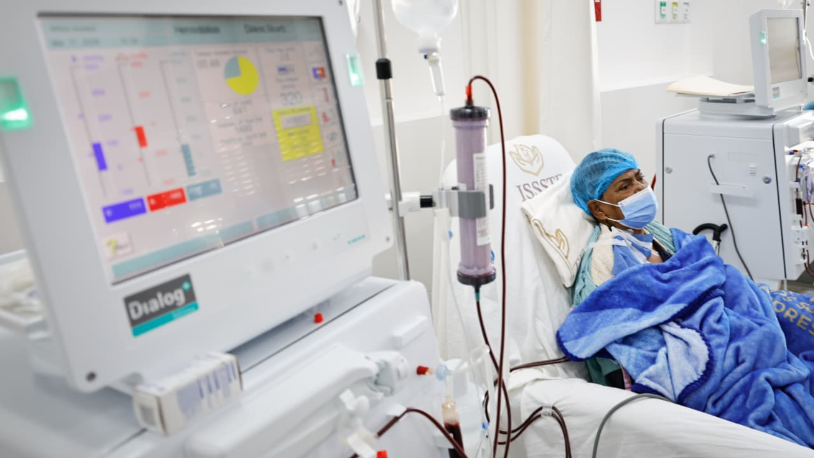 HRAE del ISSSTE en Acapulco da atención especializada en salas de hemodiálisis y hemodinamia